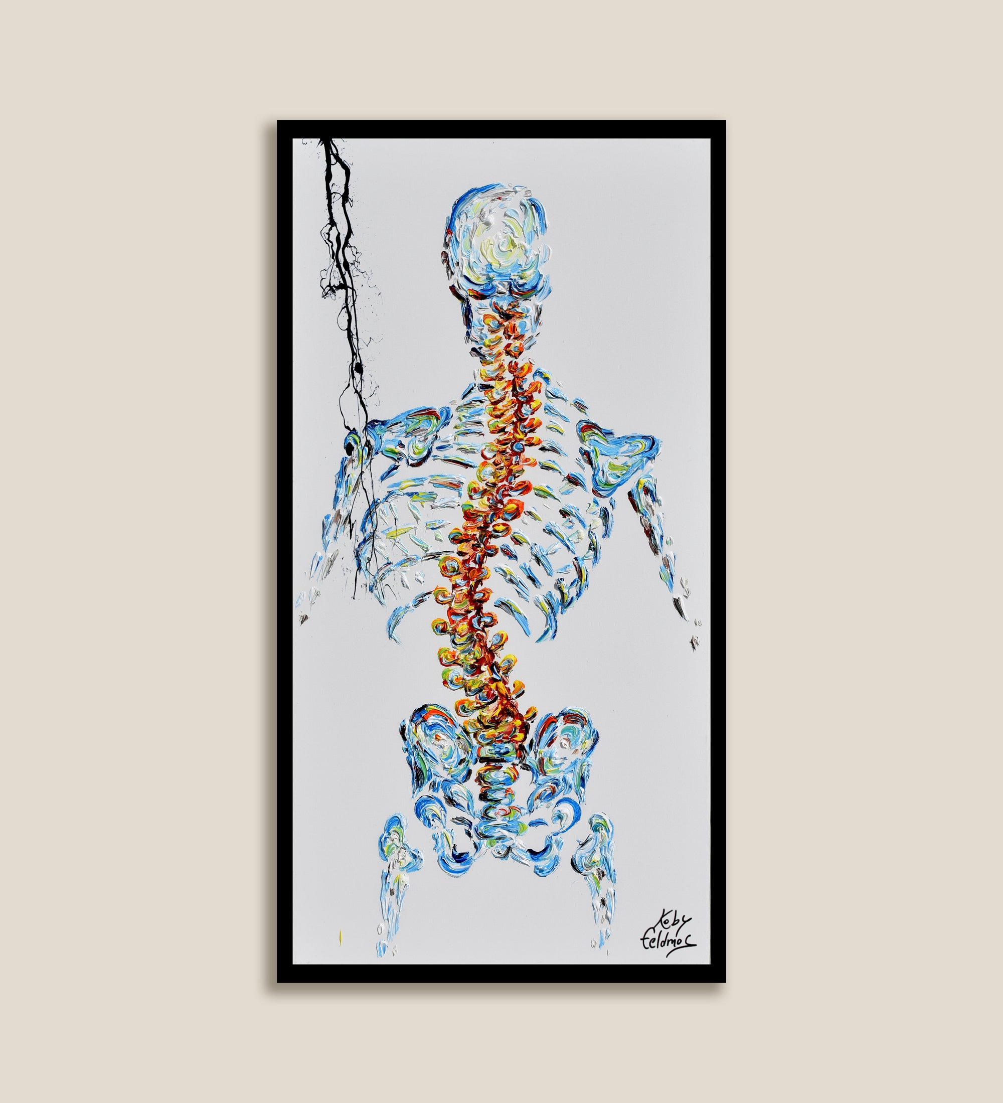 Scoliosis 55