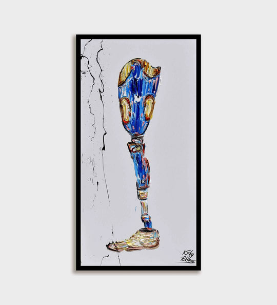 Leg Prosthesis 55