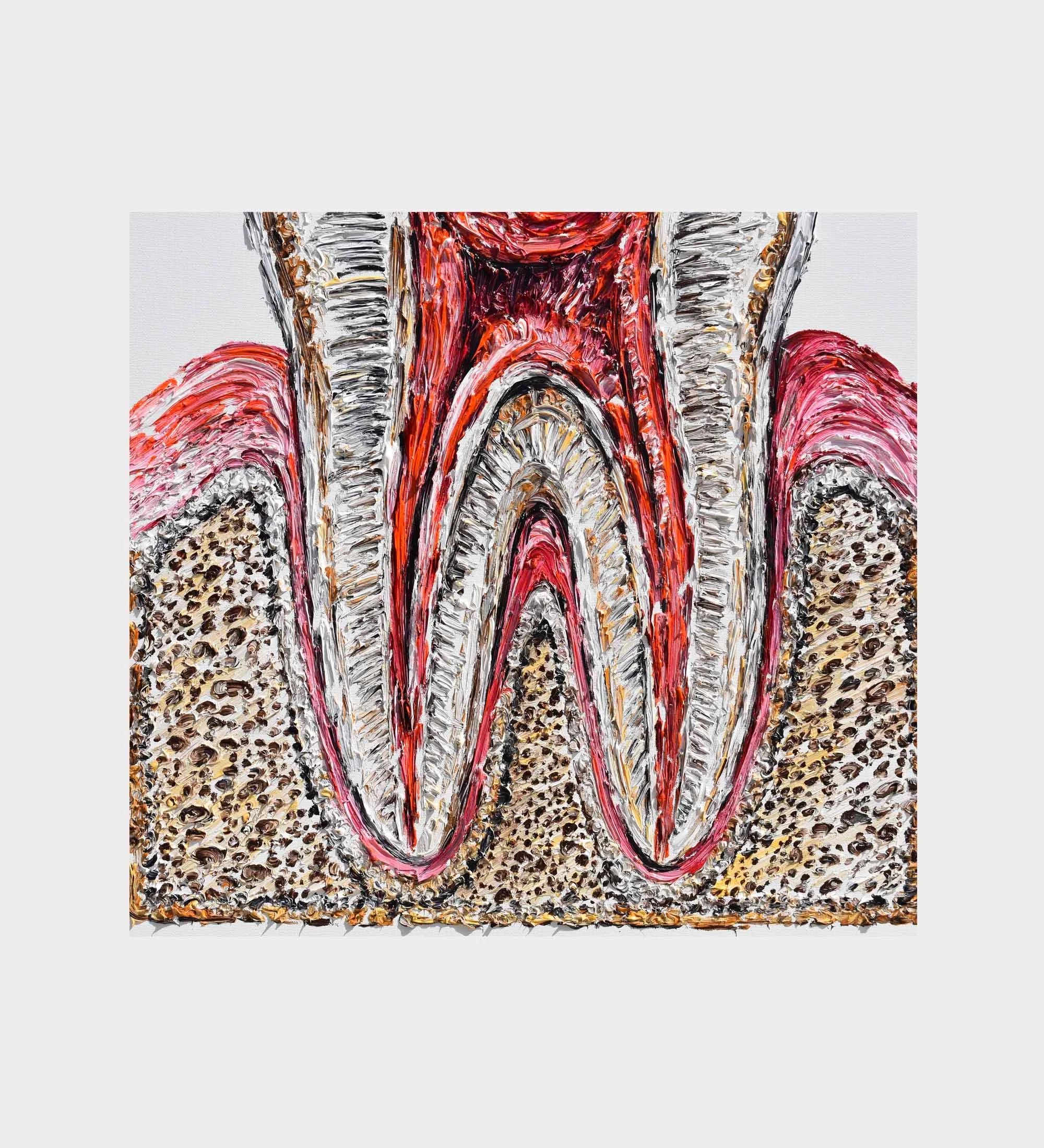 Tooth 25
